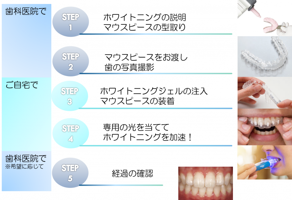 ホワイトニングの流れ | 西村歯科